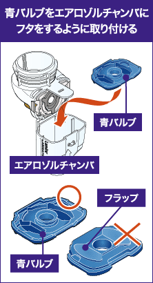 青バルブを挿入する